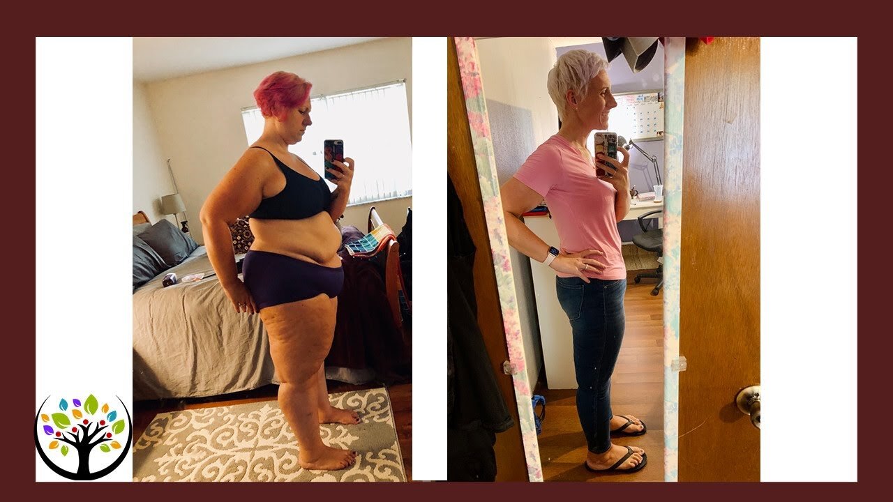 Vicki Loses Over 172 Lbs With Fasting