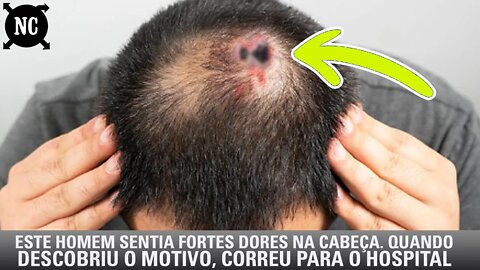 Este Homem Sentia Fortes Dores Na Cabeça. Quando Sua Mulher Olhou Mais De Perto, Correram Para...