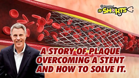 #SHORTS A Story of Plaque Overcoming A Stent and How to Solve it!