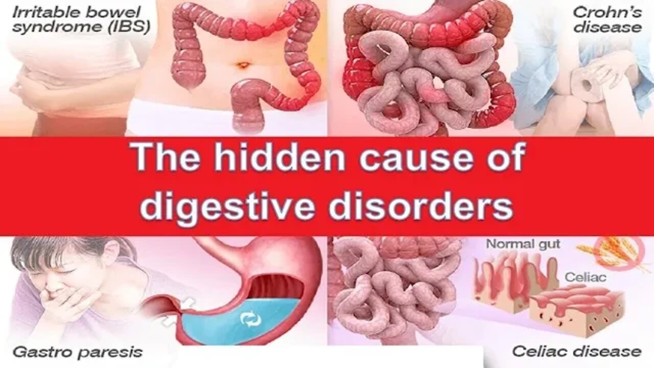 Revised information on digestive disorders