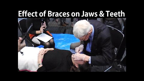 How Do Orthodontic Braces Change Upper & Lower Jaws Position & Teeth Misalignment by Prof John Mew