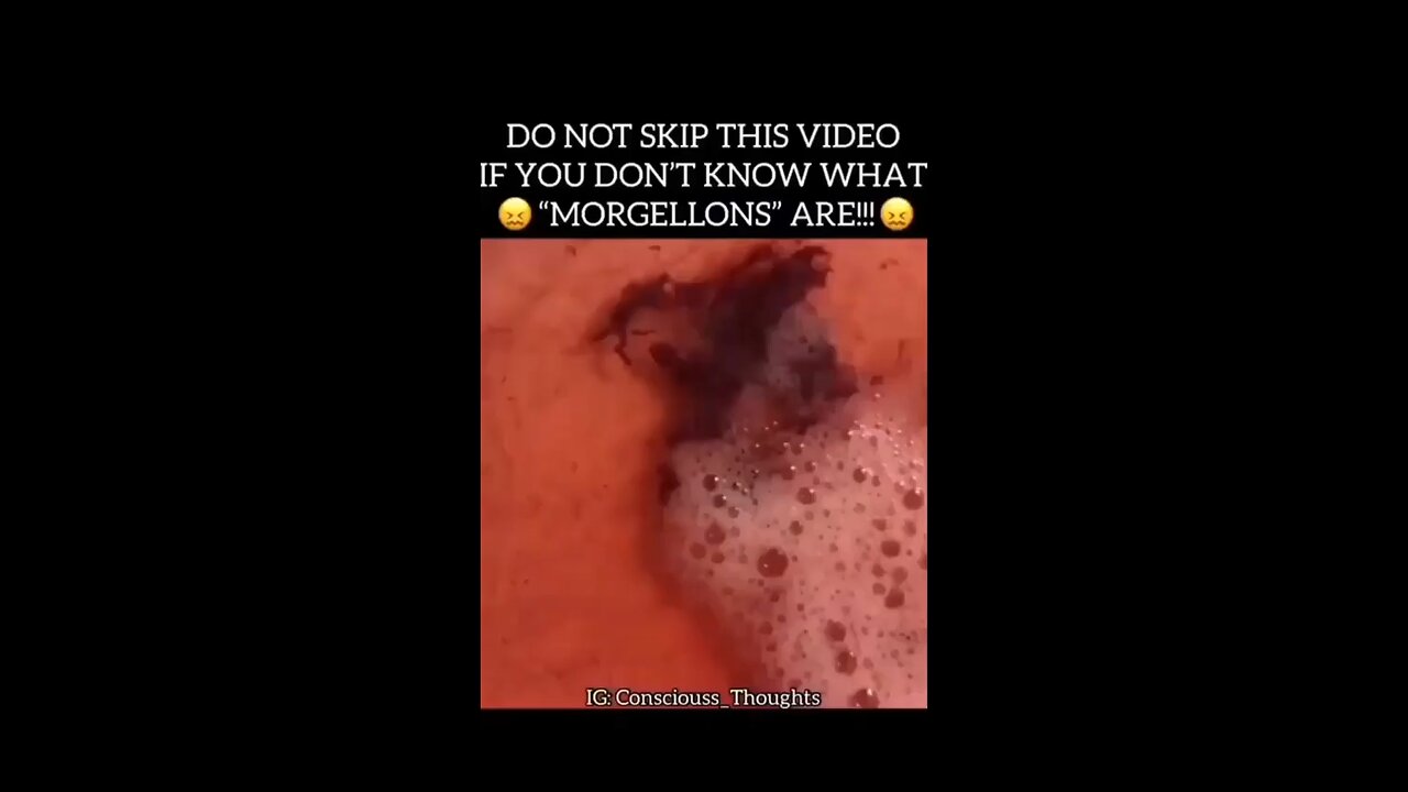 Everyone Must Do This ASAP!