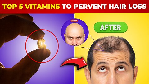 HAIR LOSS: The TOP 5 Vitamins to STOP IT