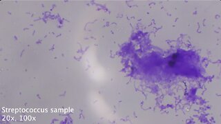 2022-10-07 Streptococcus sample