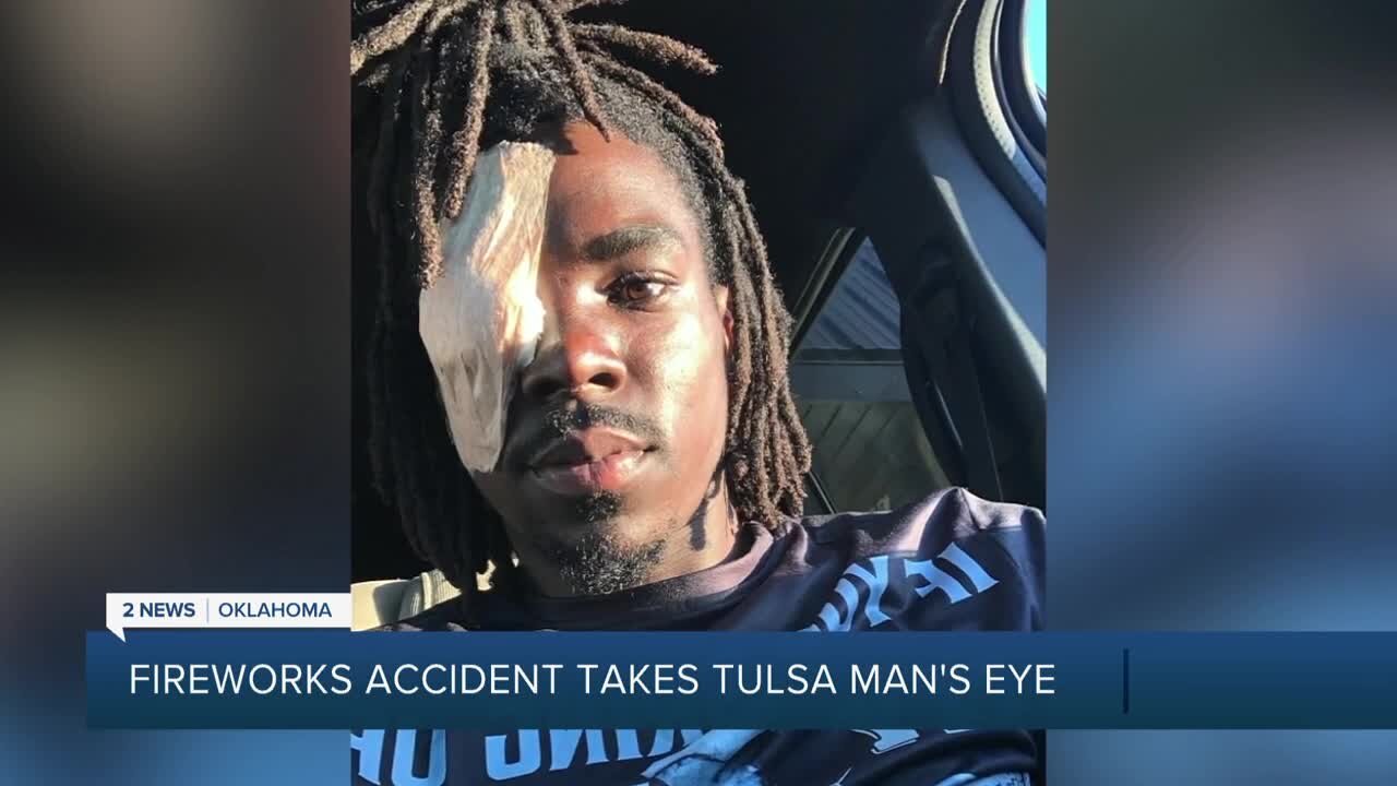 Fireworks accident takes Tulsa man's eye