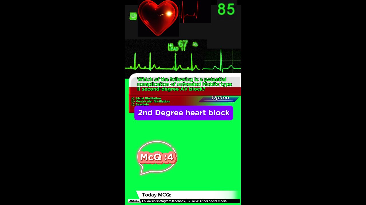 Second degree heart blockages #2nddegreeheartblock #arrthymias #CardiacArrhythmia