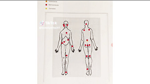 IMPLANTS • TARGETED INDIVIDUALS