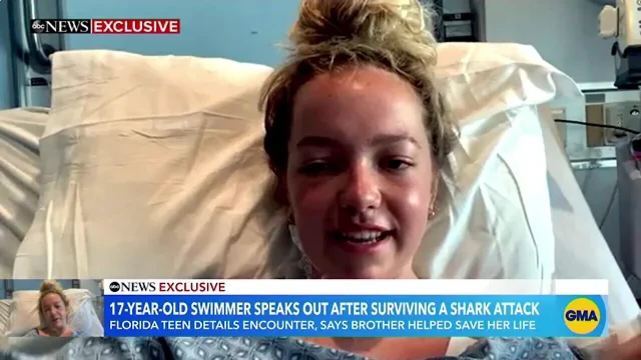 Teenage girl speaks out after surviving shark attack at Florida beach