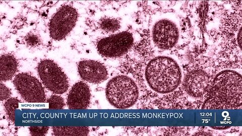 The City of Cincinnati and Hamilton County team up to address Monkeypox spread