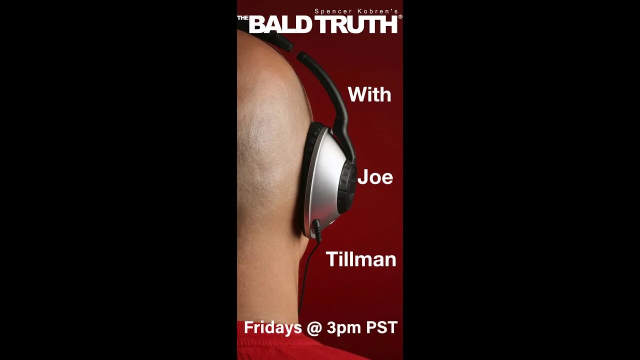 Do Hair Transplants Cause Dandruff? The Bald Truth #Shorts