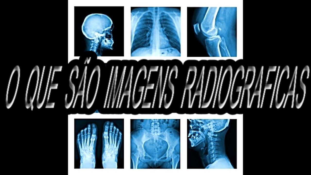 What are radiographic images?