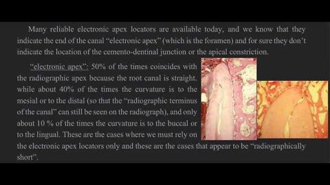 Endodontics L9 (Endodontic Obturation)