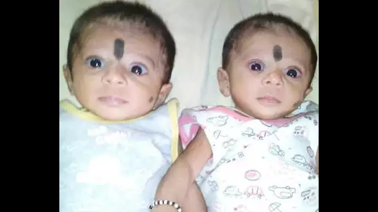 10 instances of twins harmed by vaccination