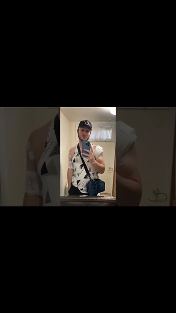 Another Update on my Surgery