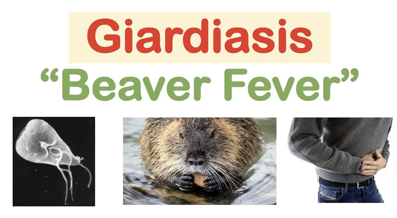 Giardiasis (Beaver Fever) Infection Sources, Pathophysiology, Signs & Symptoms, Diagnosis, Treatment