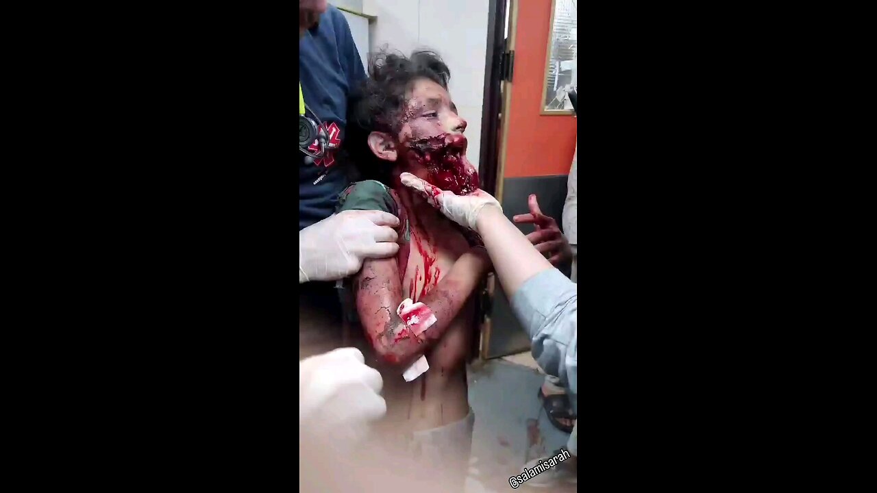 Quello che i media occidentali nascondono. Dio stramaledica israele.