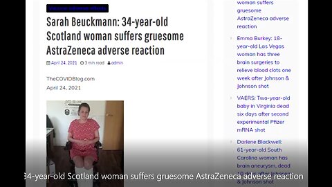 34-year-old Scotland woman suffers gruesome AstraZeneca adverse reaction