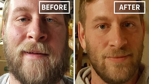 This happens when you stop drinking 😱 Amazing!