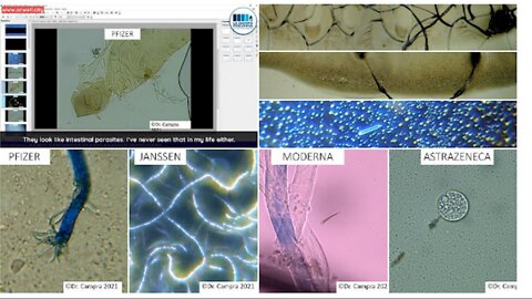 Dr.ssa Astrid Stuckelberger:"Vaccini" da TUTTO il MONDO con PARASSITI-Hydra+TRANSISTOR E OS.GRAFENE - Correzione al minuto 4.24 su Hydra : "Sarebbe venuto fuori così" Anziché "Spento-Go Out (2022)