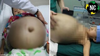 Mãe de chinesa de 12 anos nota mudança na filha. Quando os médicos a examinam, ficam paralisados