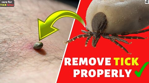 How to Remove a Tick | How to care for Tick Bite