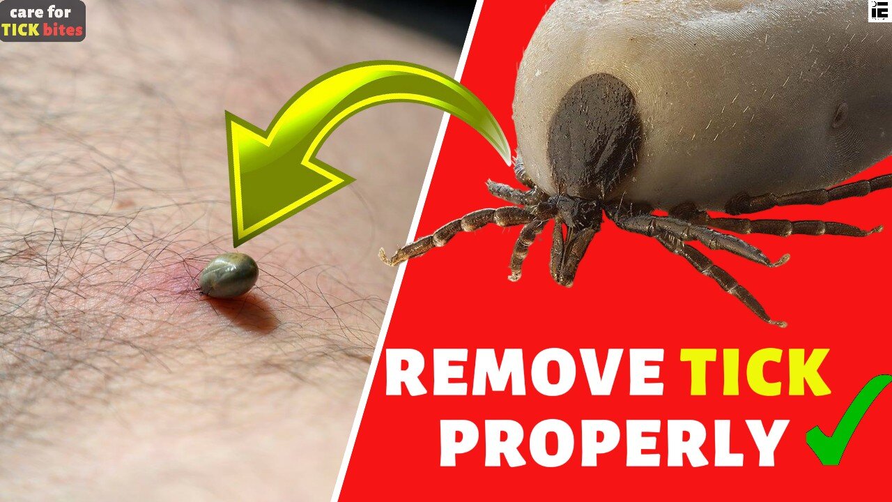 How to Remove a Tick | How to care for Tick Bite