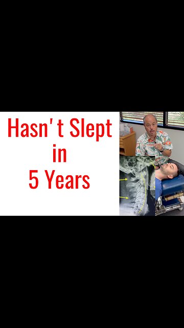Hasn't Slept in 5 Years treated by Chiropractor