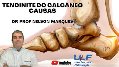 Tendinite de Calcâneo - Causas - Dr. Prof. Nelson Marques