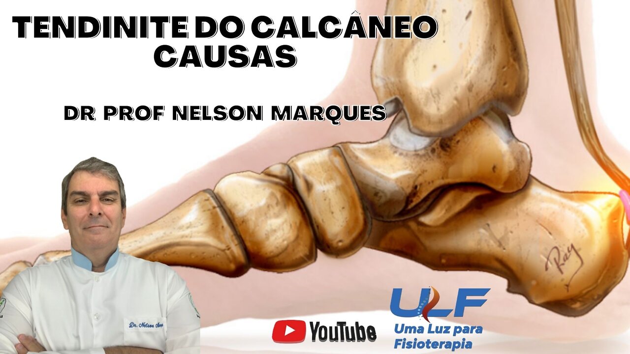 Tendinite de Calcâneo - Causas - Dr. Prof. Nelson Marques