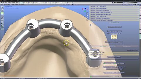 IAbutment module -Bar and clip design