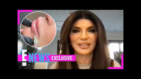 The Real Reason RHONJ’s Teresa Giudice Dissolved Her Lip Fillers (Exclusive) | E! News