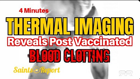 ⚫2691. mRNA Vaccine Cause of Mass Blood Clotting