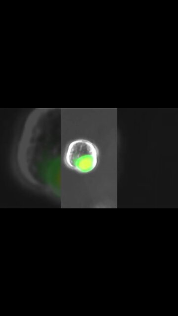 #39 Novo tipo de células foi descoberto nos pulmões humanos