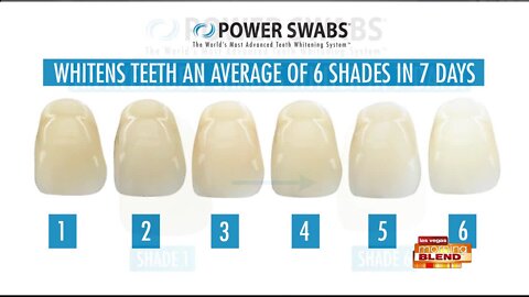 Whiten Your Teeth In Minutes