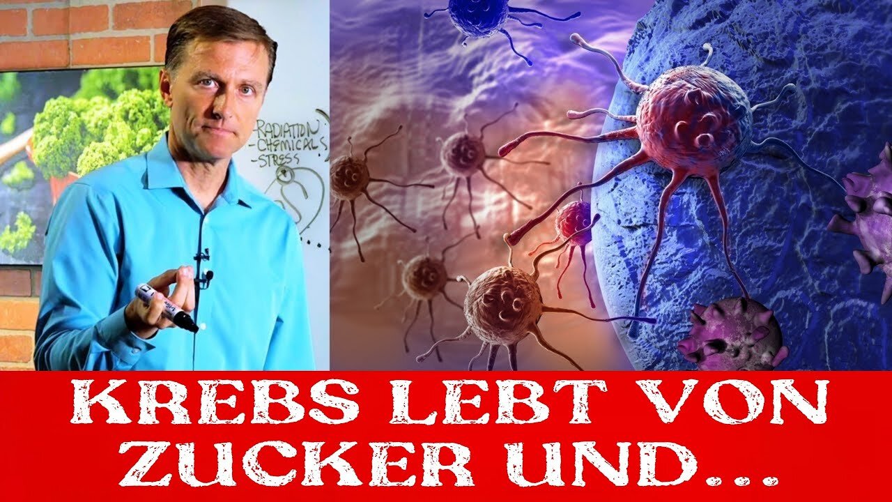 Krebs lebt von Zucker UND... etwas anderem!@Dr. Berg Deutsch.