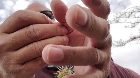 how to remove cactus 🌵 spines or lances from your body 🤔