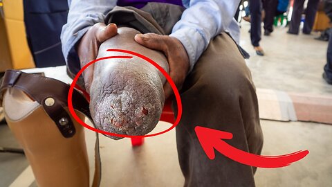 To survive these people had to CUT OFF their own limbs