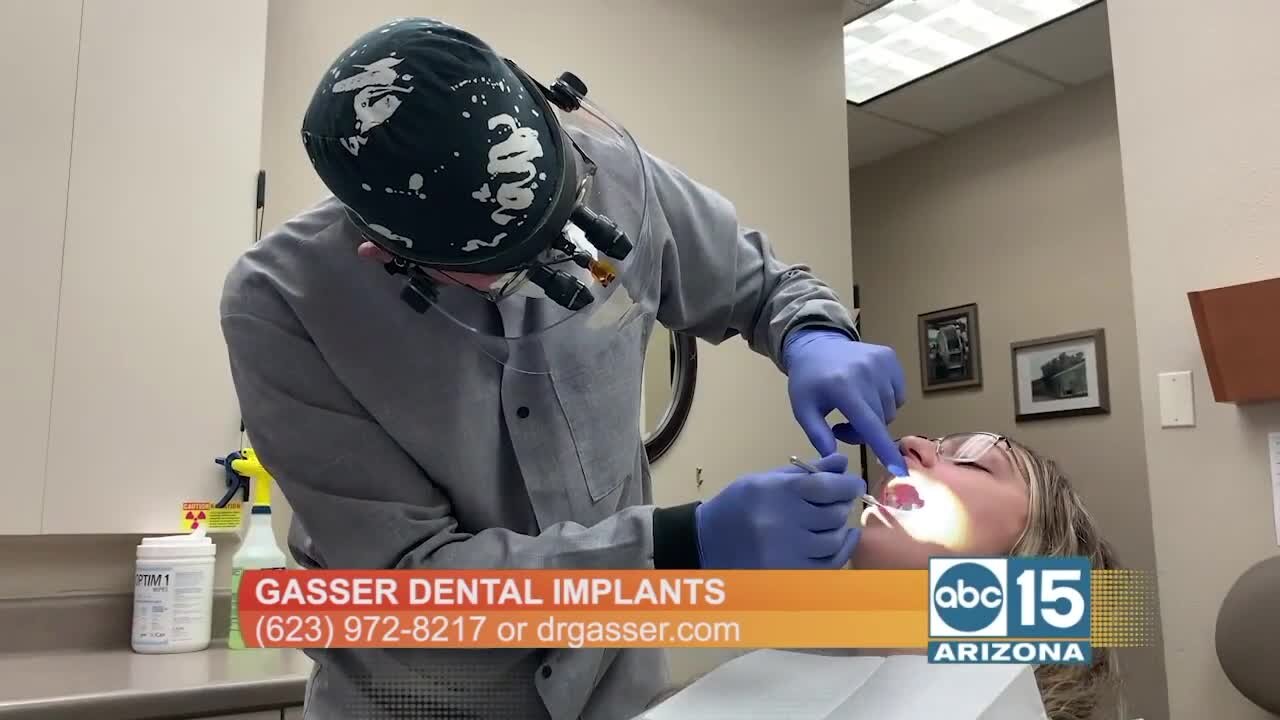 WOW! Check out how Gasser Dental Implants is "Changing Lives One Smile At a time"