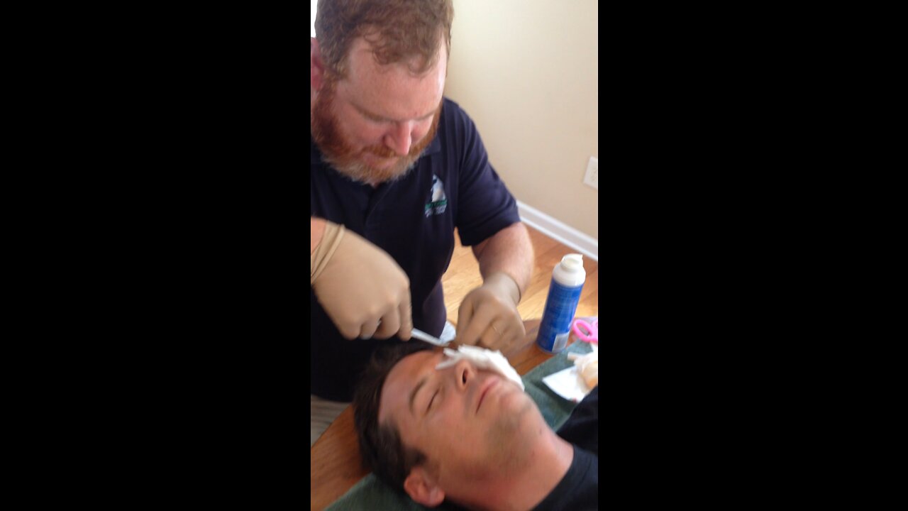 Vet giving hubby stitches on dining room table