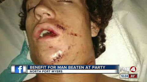 Benefit for man beating at a party