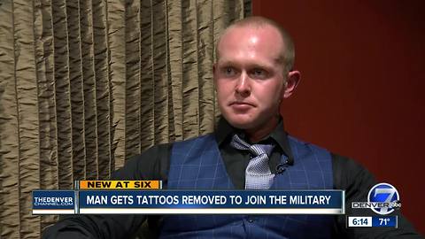 'It's time to start moving forward': Denver man removes tattoo to pursue his dream