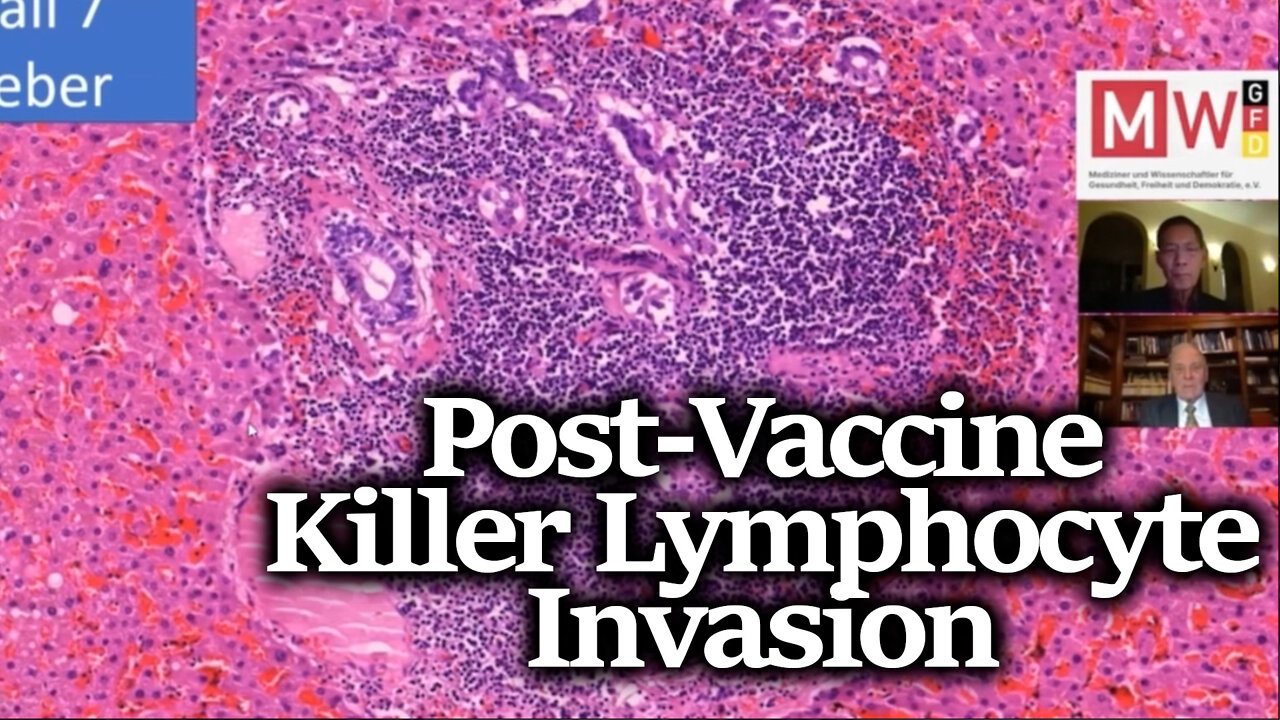 BOMBSHELL! Post-Vaccine Lymphocyte Amok Discovered By Dr. Arne Burkhardt w/ Dr Bhakdi & Dr. Palmer