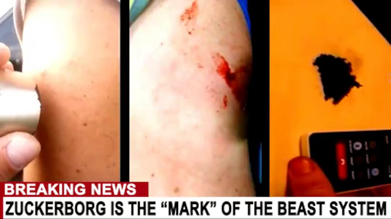 ZUCKERBERG ADMITS VACCINE IS POISON - NO ONE SHOULD TAKE THE VACCINE