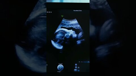 Cute Baby Ultrasound