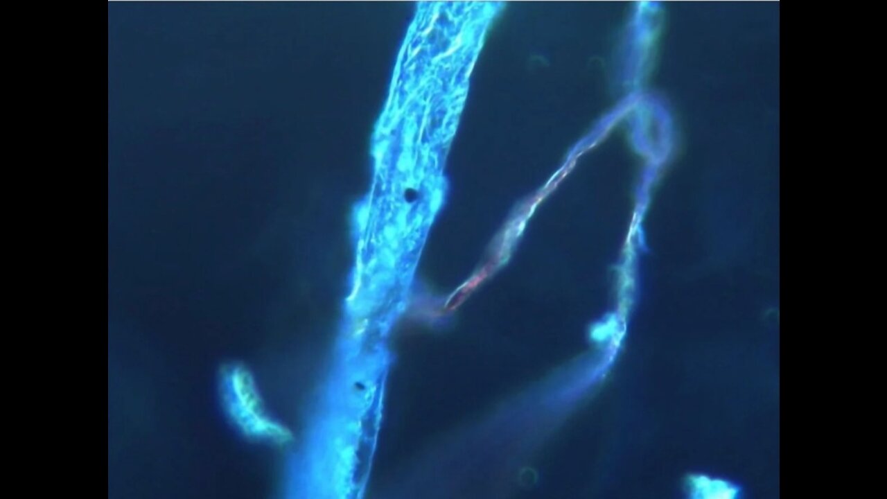 More Blood Clots That Look Alien Very Disturbing