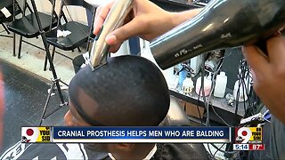 Barber in Over-the-Rhine boosts hairline, confidence for men experiencing hair loss