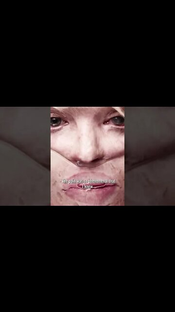 Katie Piper was used to gaining attention for her looks. But when her stalker Danny Lynch hired