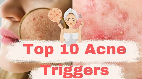 "Top 10 Acne Triggers: Expert Tips for Clear, Glowing Skin"