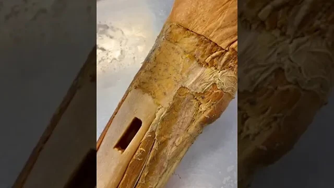 What's On the Surface of Bones?