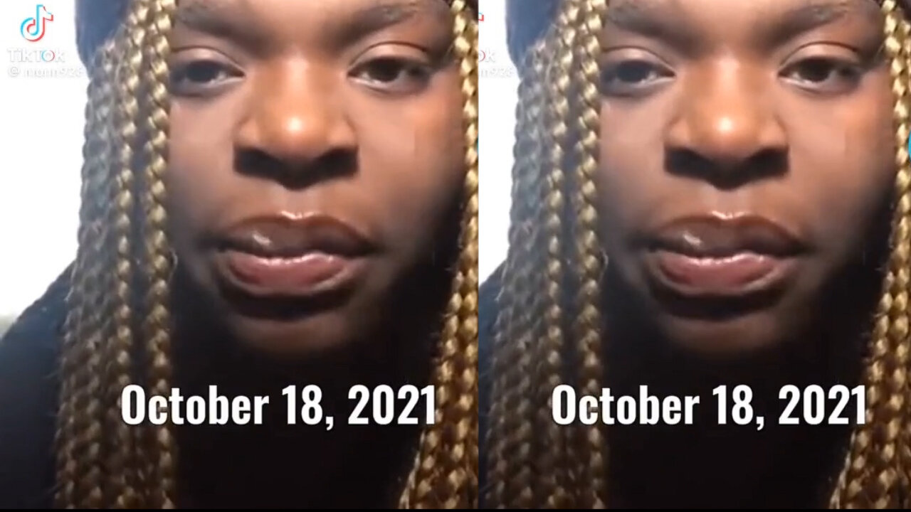 Scar Lip Explains How She Got Her Name